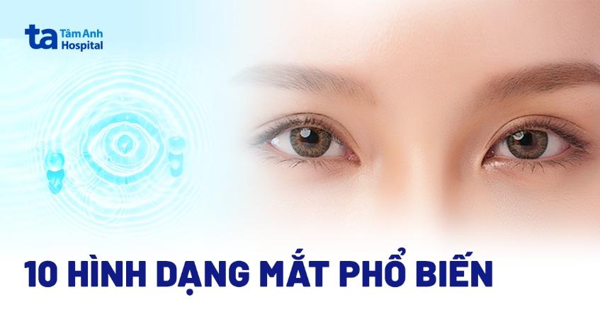 các kiểu mắt