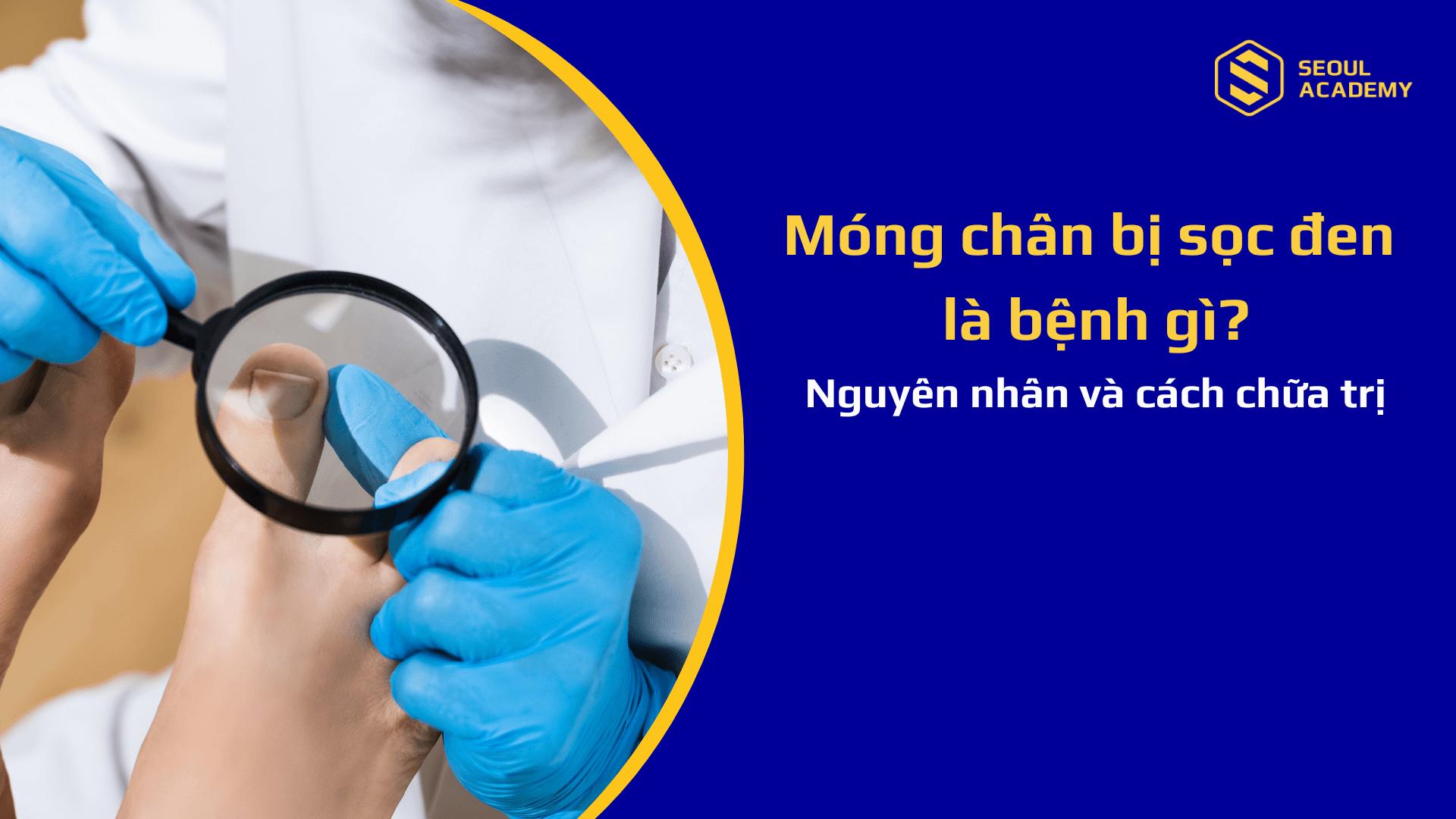 Cơ thể suy nhược cũng khiến móng chân bị sọc đen