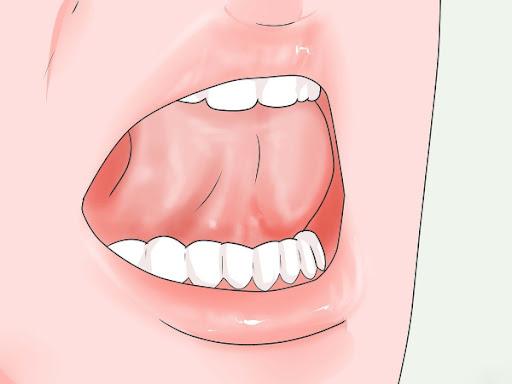 Tư thế đặt lưỡi đúng cách