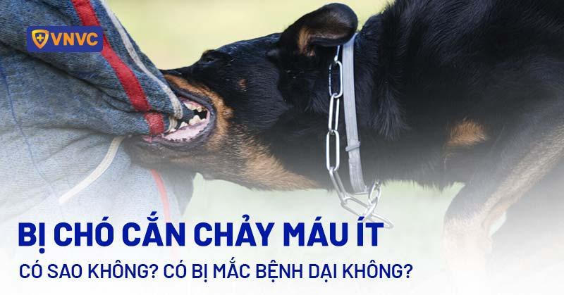 bị chó cắn chảy máu ít có sao không