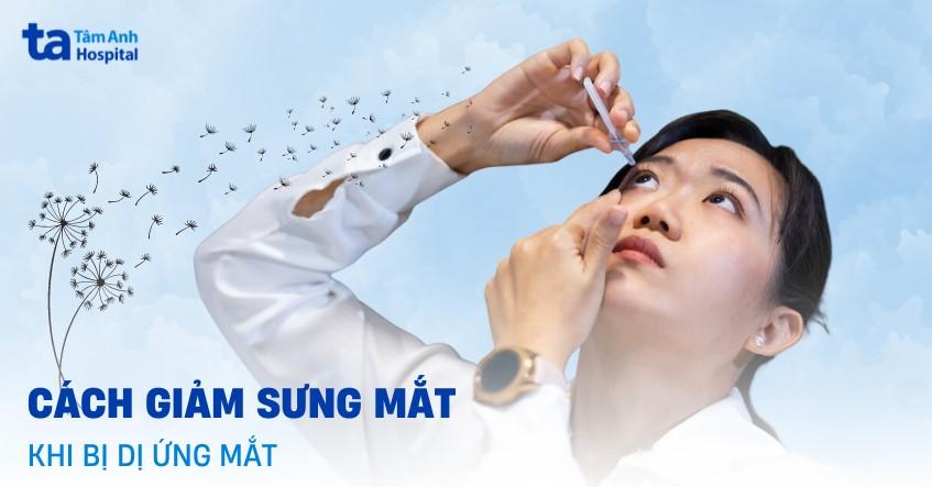 cách làm giảm sưng mắt khi bị dị ứng mắt