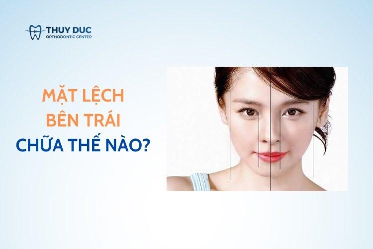 Mặt lệch bên trái có cách nào để cải thiện? 1