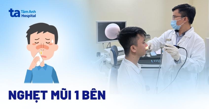 nghẹt mũi 1 bên