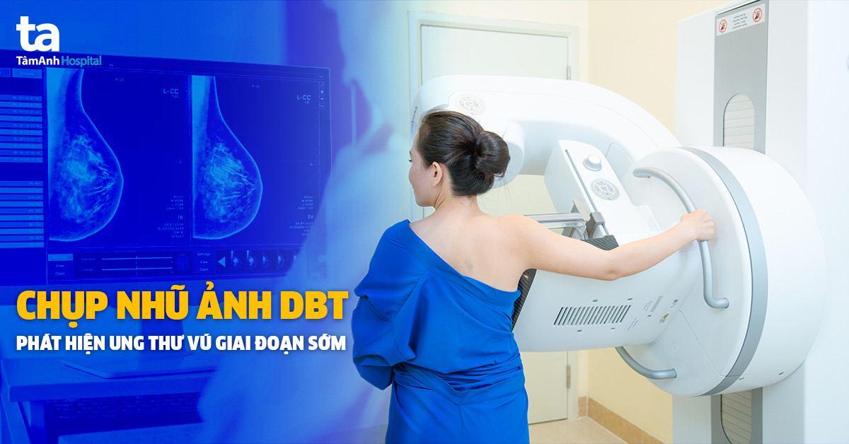 chụp nhũ ảnh chẩn đoán ung thư vú