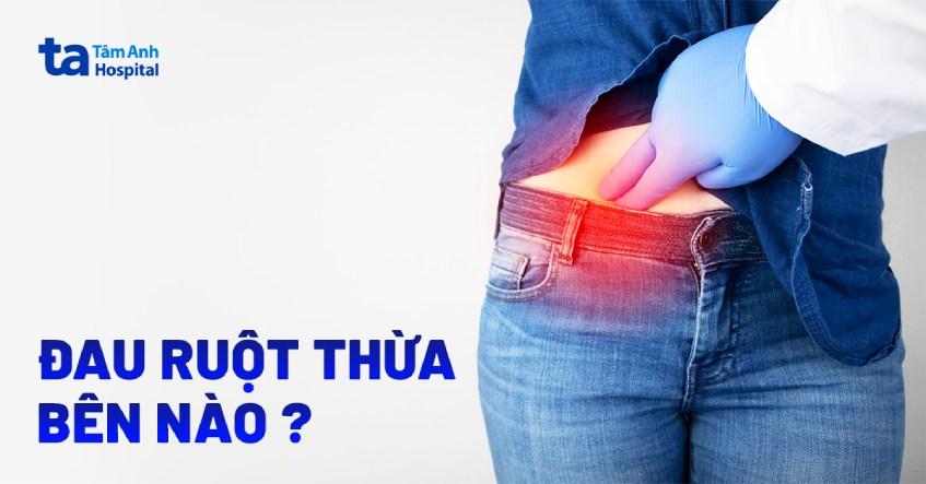 ruột thừa đau bên nào