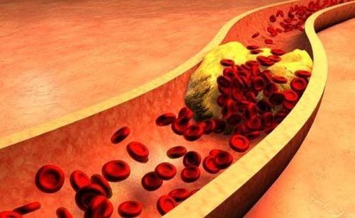 Những người ăn ớt đỏ đã được chứng minh là có mức cholesterol LDL thấp hơn.