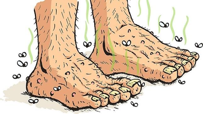 Mẹo nhỏ nhưng cực hiệu quả dành cho người hôi chân ảnh 1