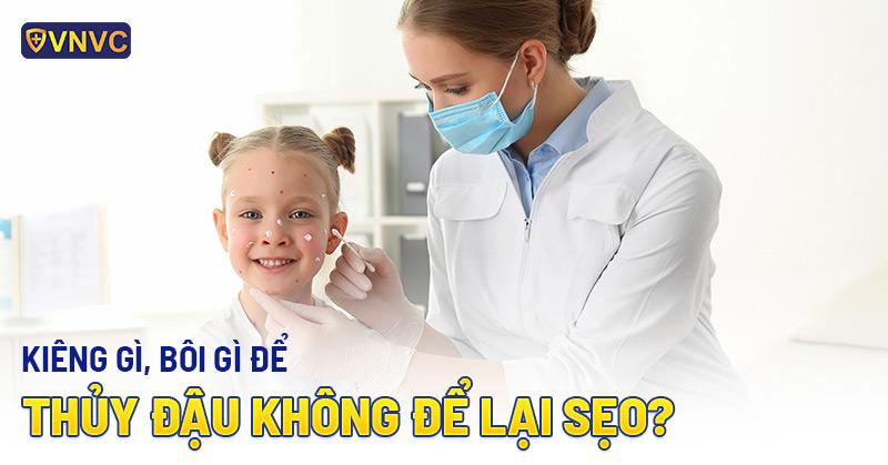 bệnh thủy đậu kiêng gì