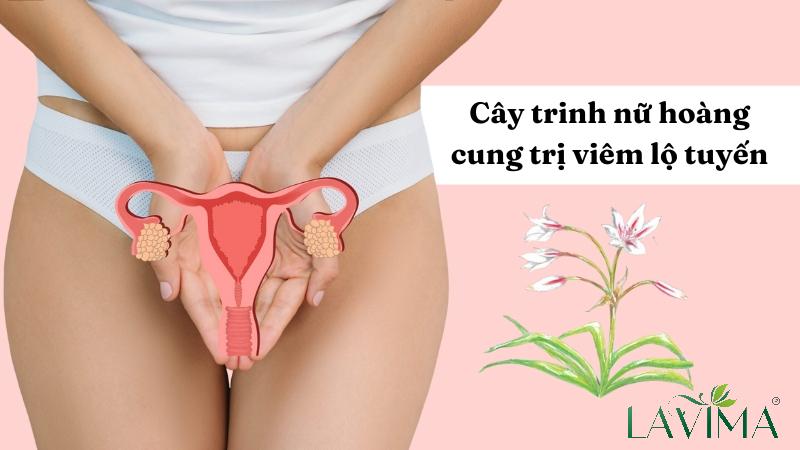 Thực hư cây trinh nữ hoàng cung trị viêm lộ tuyến có hiệu quả không?