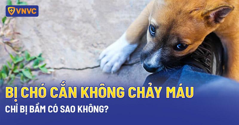 bị chó cắn không chảy máu chỉ bị bầm có sao không