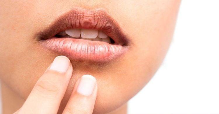 Mất nước có thể khiến người bệnh gặp tình trạng khô miệng