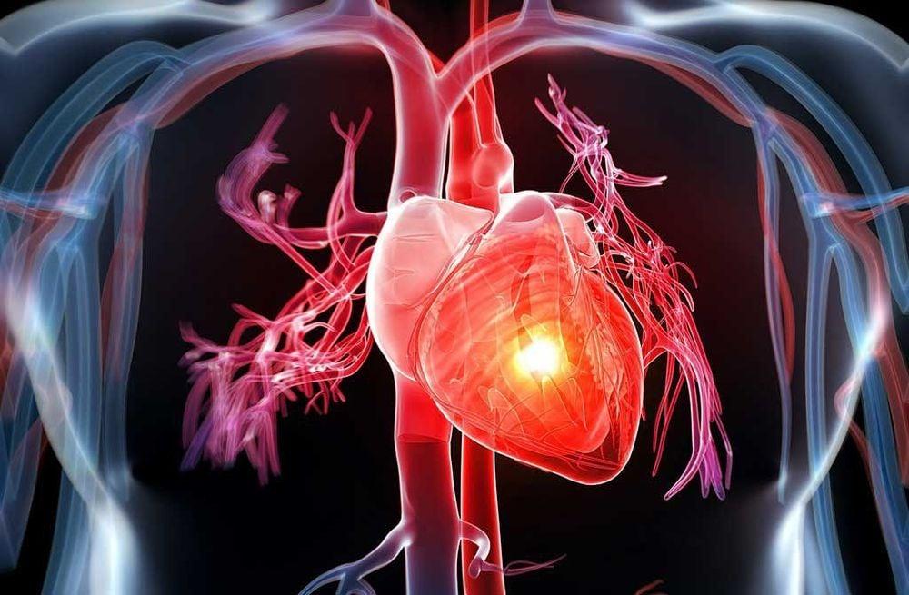 Ăn mặn là nguyên nhân gây bệnh tim mạch