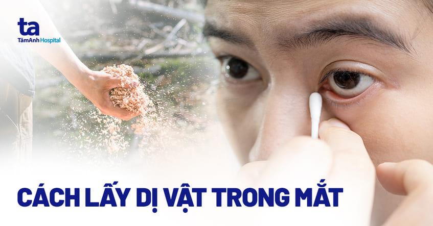 Cách lấy dị vật trong mắt