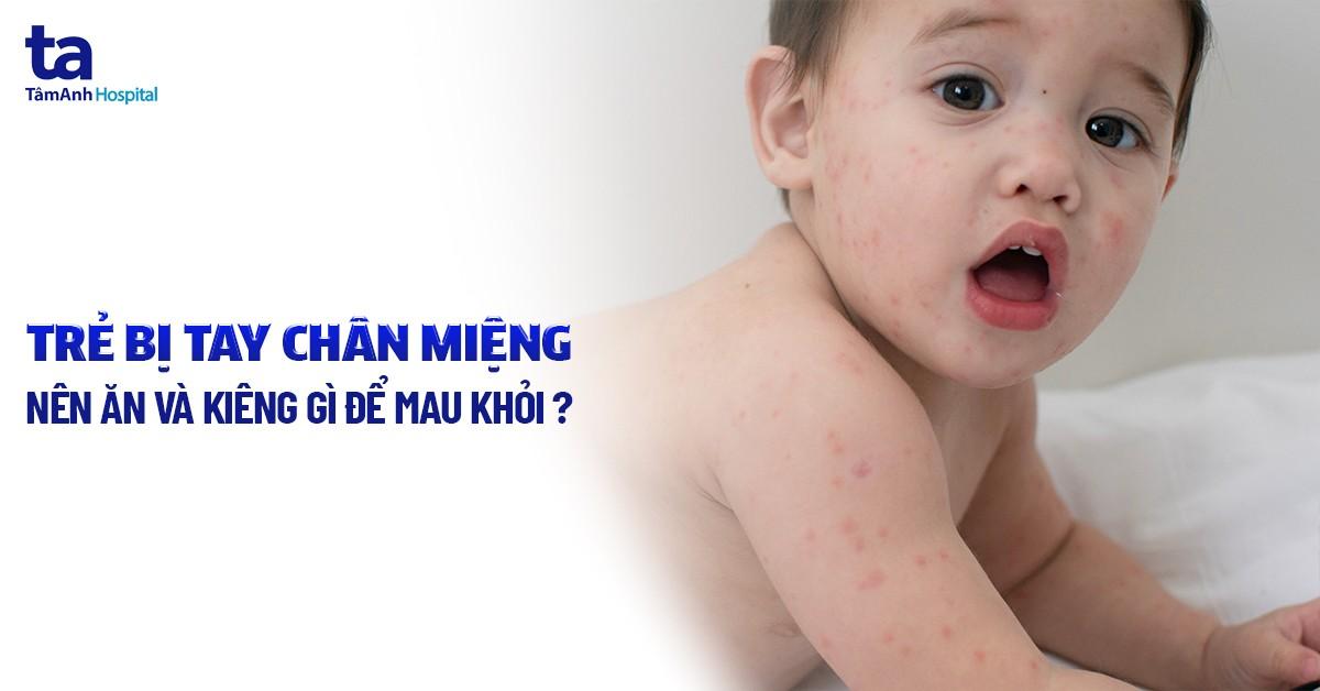 Trẻ bị tay chân miệng kiêng gì và nên ăn gì mau khỏi